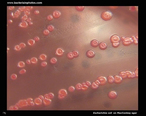 appearance of lactose positive colonies on MacConkey